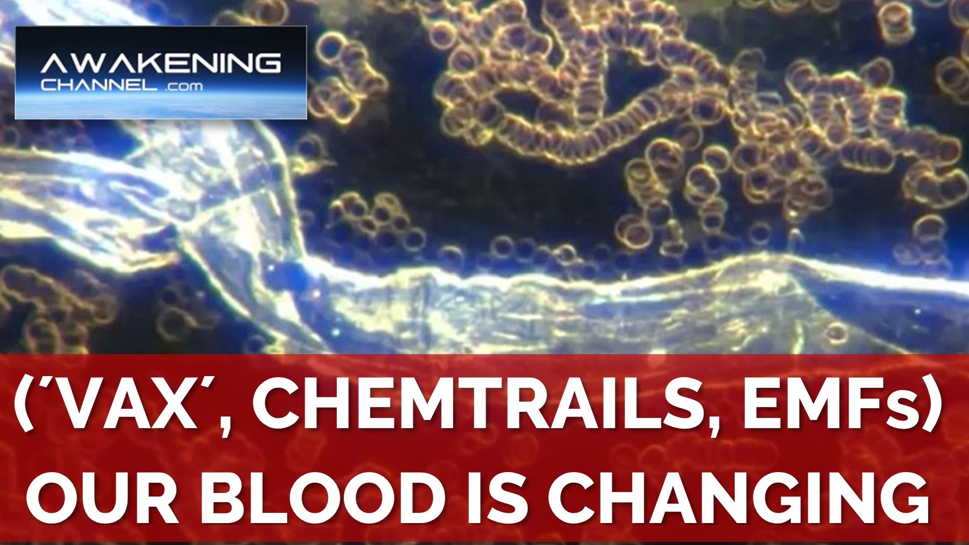 (´Vax´, Chemtrails, EMFs). Our Blood Is Changing